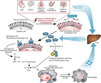 C-Reactive Protein Triggers Cell Death in Ischemic Cells